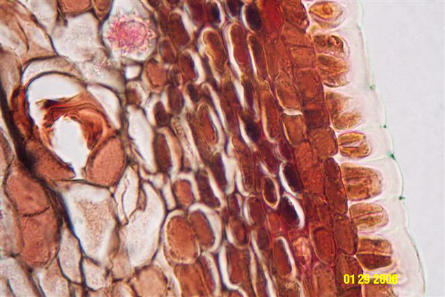 Bob's microphotograph #1